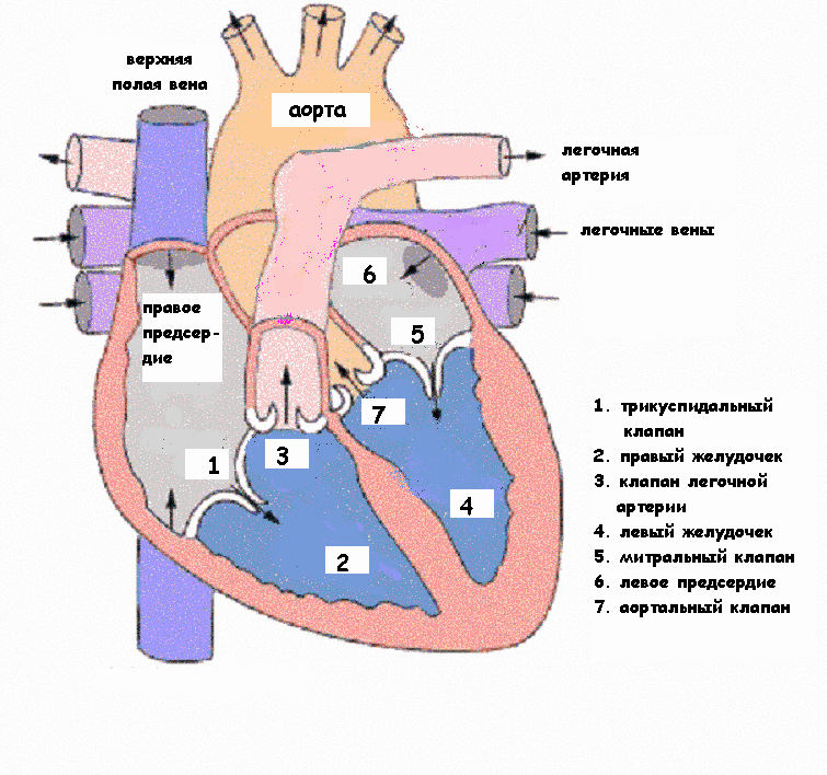 Отверстия в предсердиях. Врожденный порок сердца ДМЖП. Дефект мембранозной части межжелудочковой перегородки. Врожденный порок сердца мышечный дефект межжелудочковой перегородки. Дефект межжелудочковой перегородки внутриутробно.